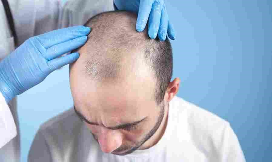 Hair Transplant London – How to Choose the Right Clinic