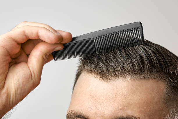 Hair Transplant Price in Turkey vs USA: Huge Savings Explained